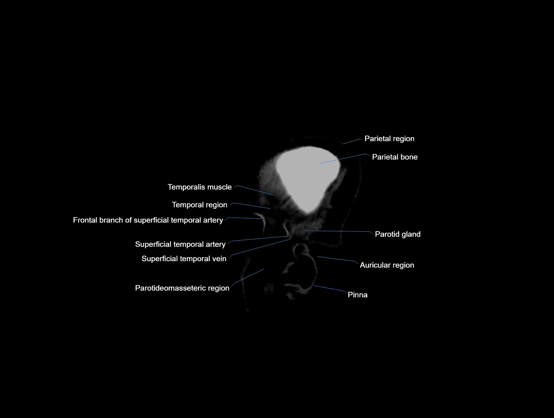 CT scan brain sagittal cross sectional anatomy image-img-00001-00003.webp
